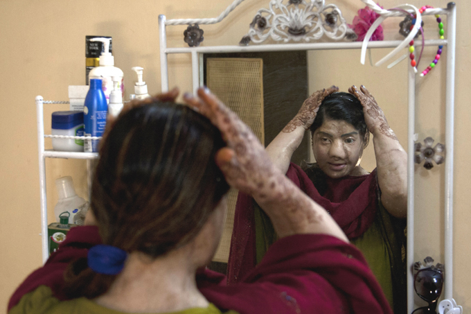 Красавицы Пакистана. К сожалению, бывшие... По словам доктора Шахмалака, подобный вид преступлений далеко не редкость в Пакистане. Некоторым женщинам серную кислоту в лицо плескали не только отвергнутые поклонники, но и рассерженные мужья и даже отцы. женщины, Пакистан, насилие, пластический хирург