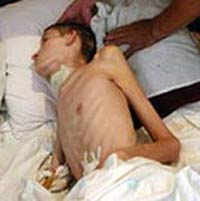 Сержант умер в день призыва после годичной комы