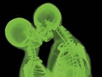 Нужно ли бояться рентгеновского обследования