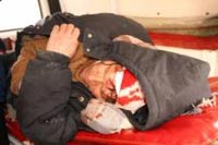 Рыбак пробурил лунку в голове друга