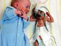 Брат морил голодом брата в утробе матери