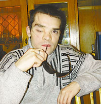 Врачи пришили отрубленную голову