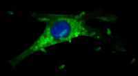 Toxoplasma gondii (окрашена зелёным) атакует клетку мыши