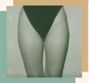 Липосакция