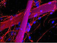 Учёные разработали шёлковый ремонт нервов