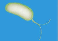 патогенная бактерия - вызывает более чем 90% язв патогенная бактерия - вызывает более чем 90% язв