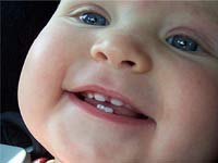 Зубастые младенцы появляются все чаще?